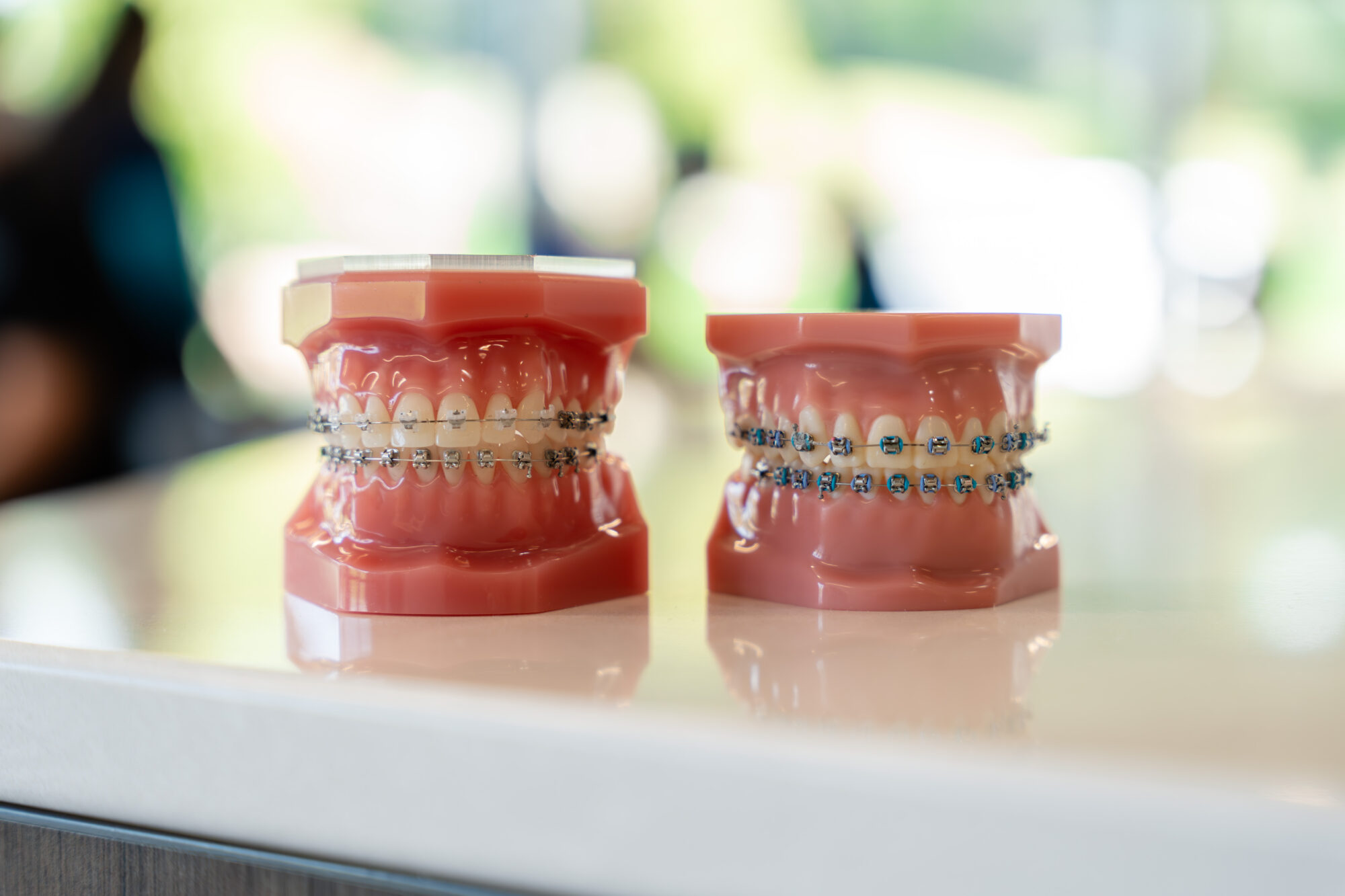 hawley-ortho-patient-int-04181