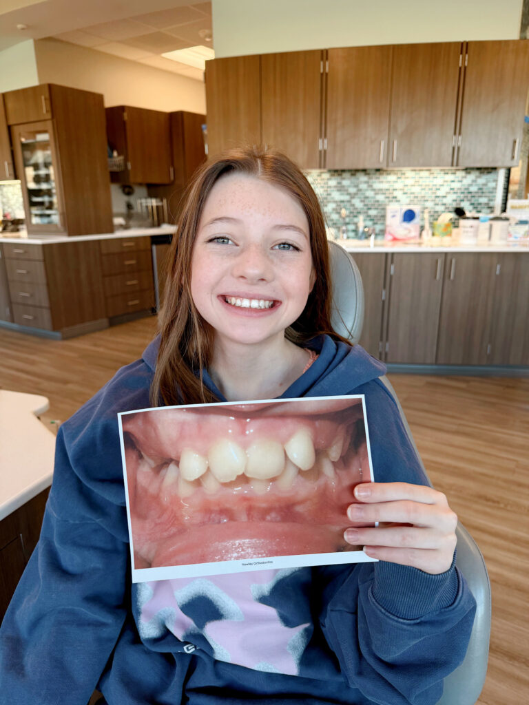 1EC400D1-189E-40E1-ABA6-BDE7FD34788B braces omaha