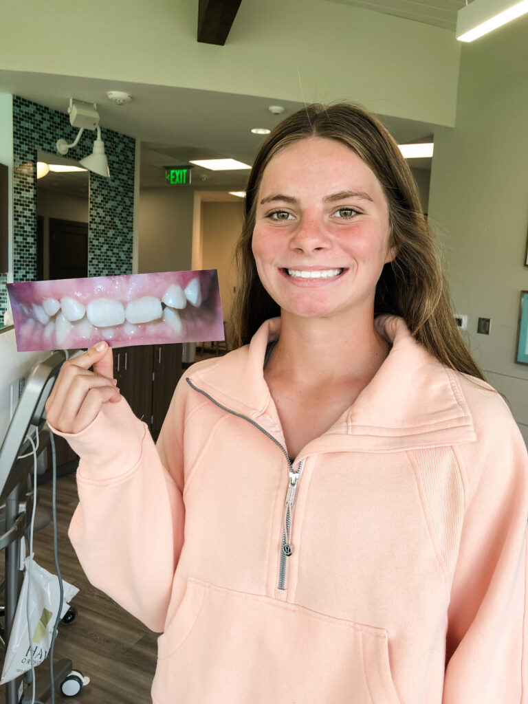 Photo Aug 22 2022, 1 58 46 PM braces omaha