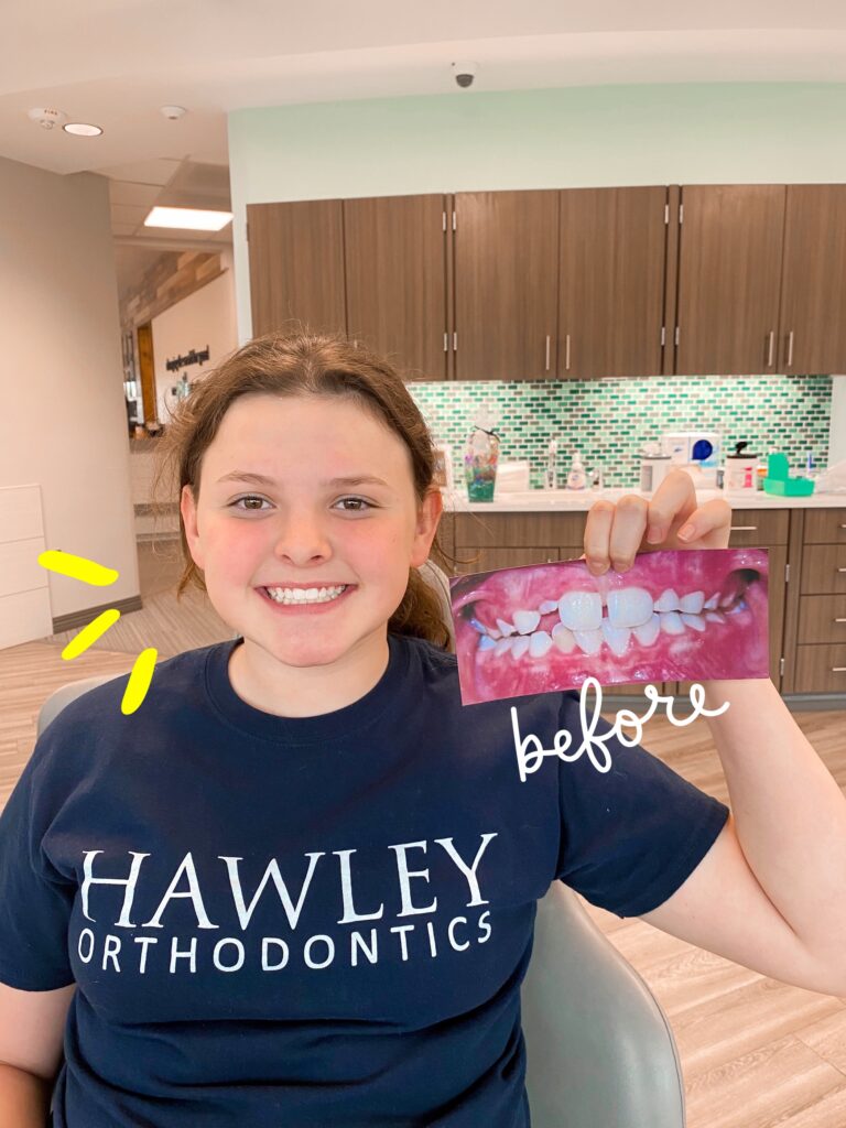 Photo Dec 03 2024, 8 22 28 AM braces omaha