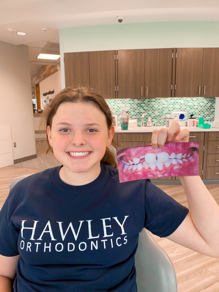 Photo May 15 2023, 9 12 49 AM braces omaha