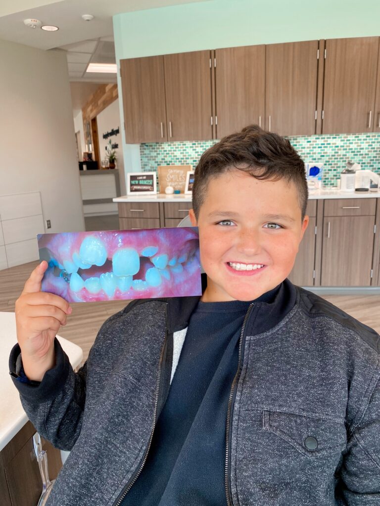 Photo Nov 29 2022, 9 38 39 AM braces omaha