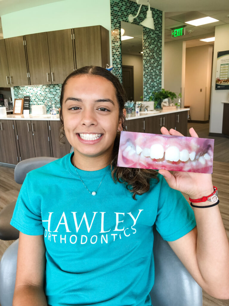 Photo Sep 14 2022, 9 59 05 AM braces omaha