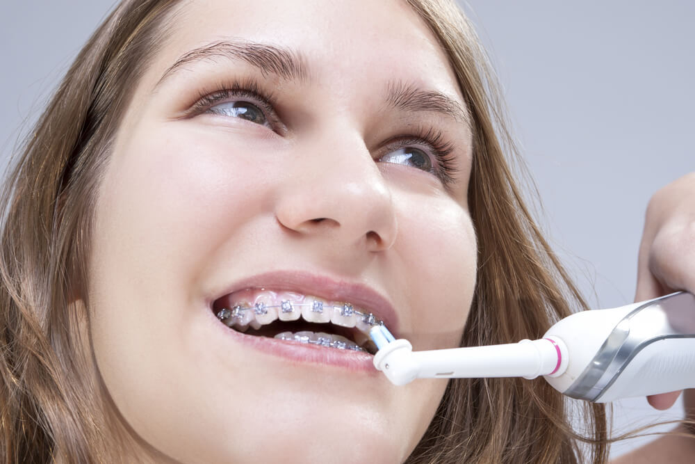 On-the-Go Teeth Cleaning Essentials for Braces Wearers