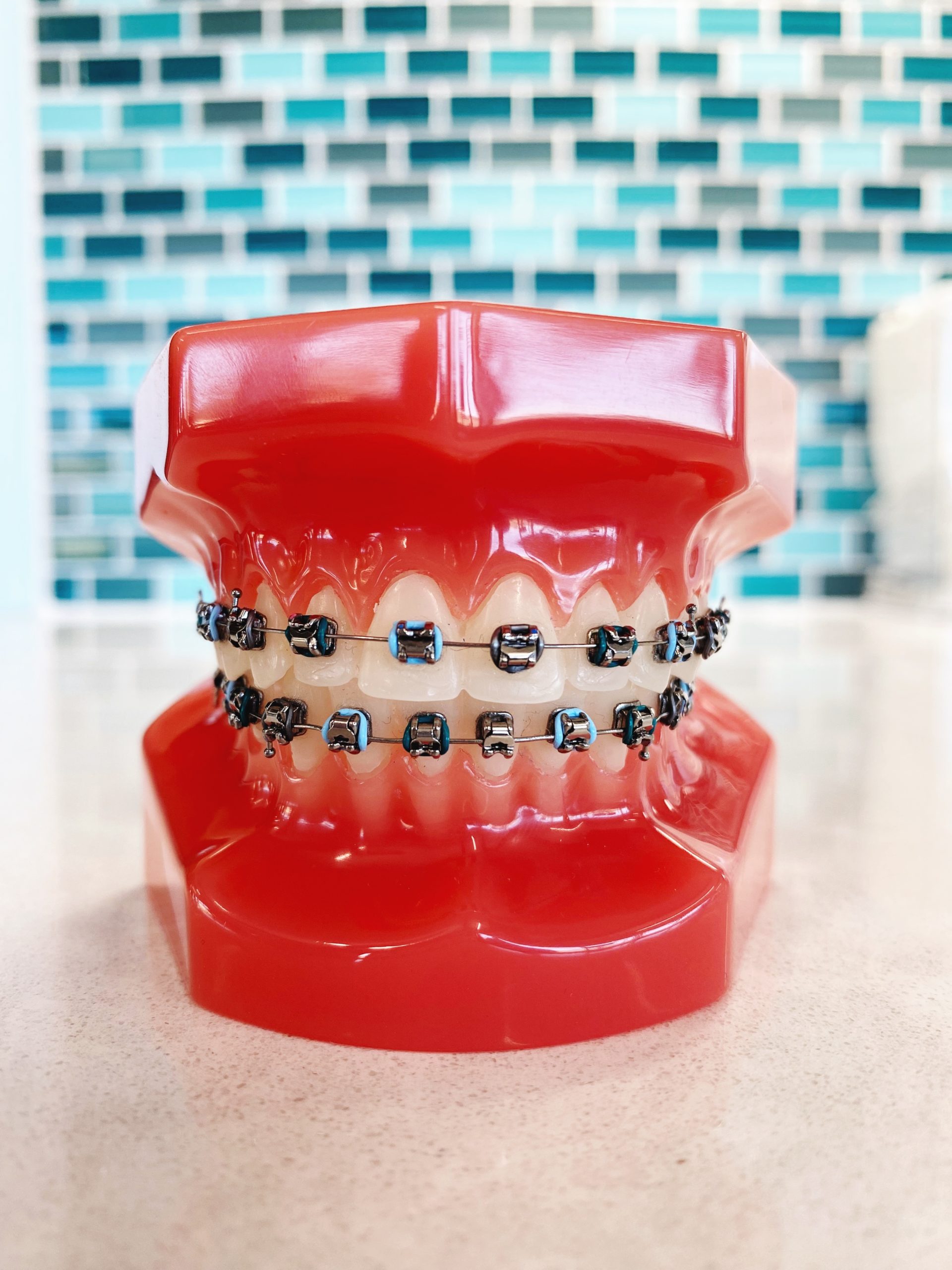 Braces Band Colors To Make Teeth Look Whiter